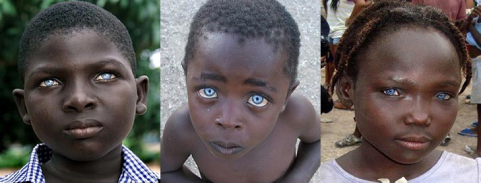 Dark skinned Africans with extraordinary blue eyes